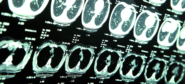 MRI of human brain.