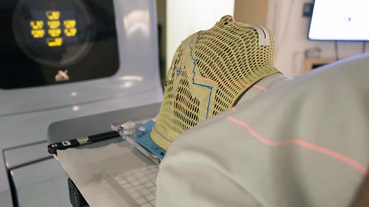 Patient radiation therapy mask showing laser lines for targeting cancer cells in the brain.