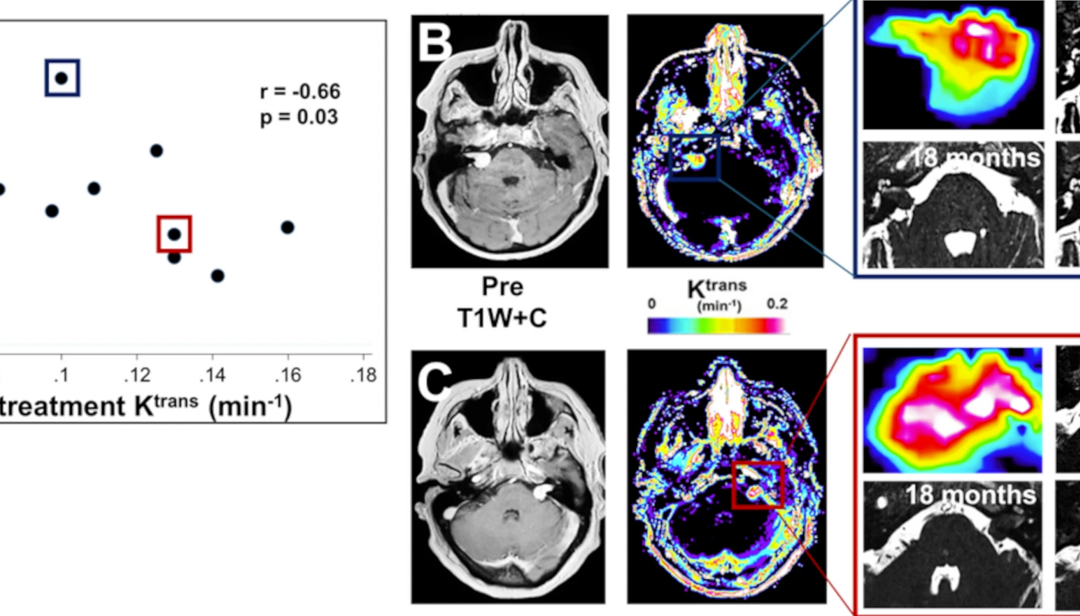 Translating imaging research into clinical impact