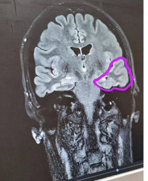 A brain scan.