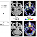 Translating imaging research into clinical impact